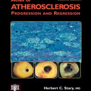 Atlas of Atherosclerosis Progression and Regression (Encyclopedia of Visual Medicine Series)